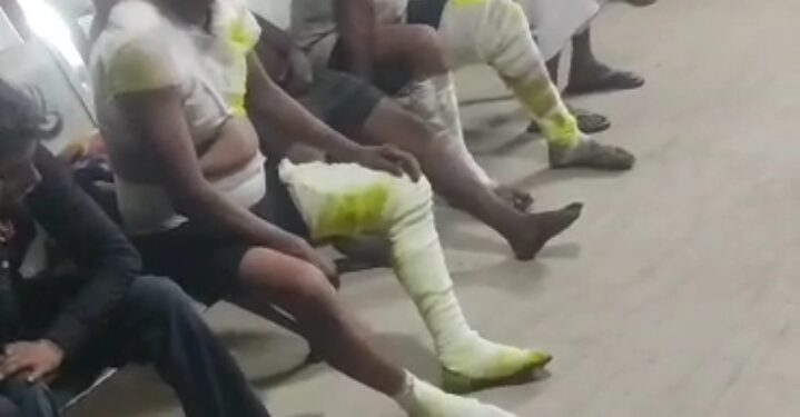 बड़ी खबर: रुड़की में बड़ा धमाका, 15 लोगों से ज्यादा घायल