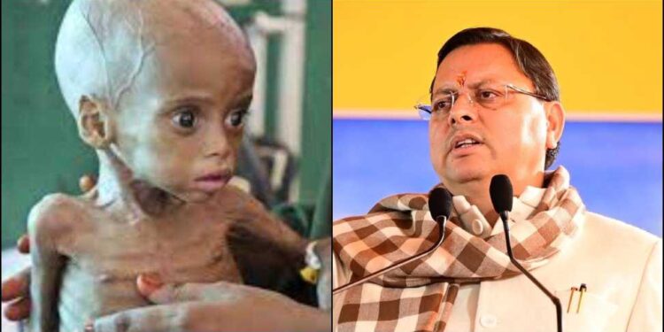 उत्तराखंड में कुपोषण: बच्चों के स्वास्थ्य के लिए बढ़ता खतरा